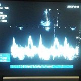 2012-02-18 10.32.05  My heart as seen with a ultrasound.  Barb &#38; I were the subjects for a traing session on how to use untrasiund machines.